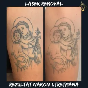 Laser-nova